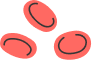 anemia