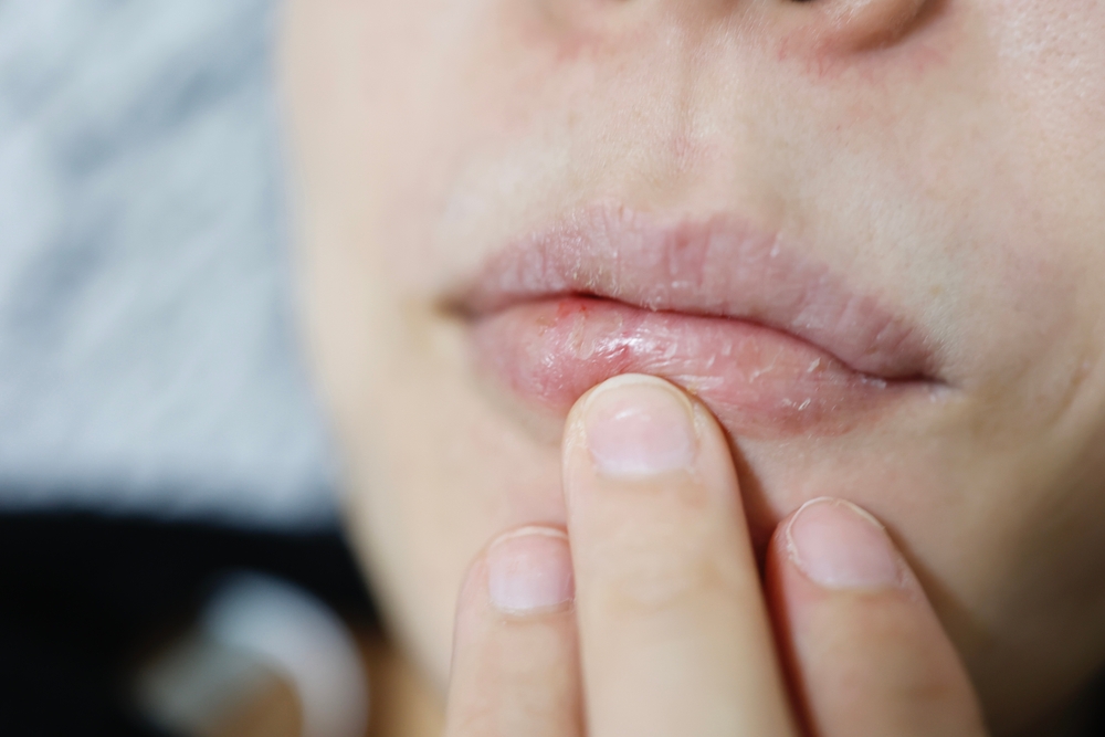 עור יבש בחורף – 7 טיפים לעור יבש בתקופה הקרה